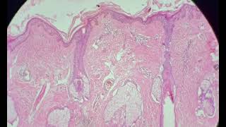 Histology of thin skin slide identification and explanation [upl. by Nisse]