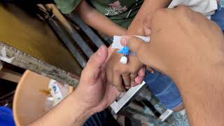 Intravenous iv Cannulation  नस में cannula लगाना सीखे  IV Cannulation  Inject cannula for vein [upl. by Laure]