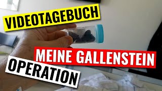 Videotagebuch zur Operation meiner Gallensteine [upl. by Costello]